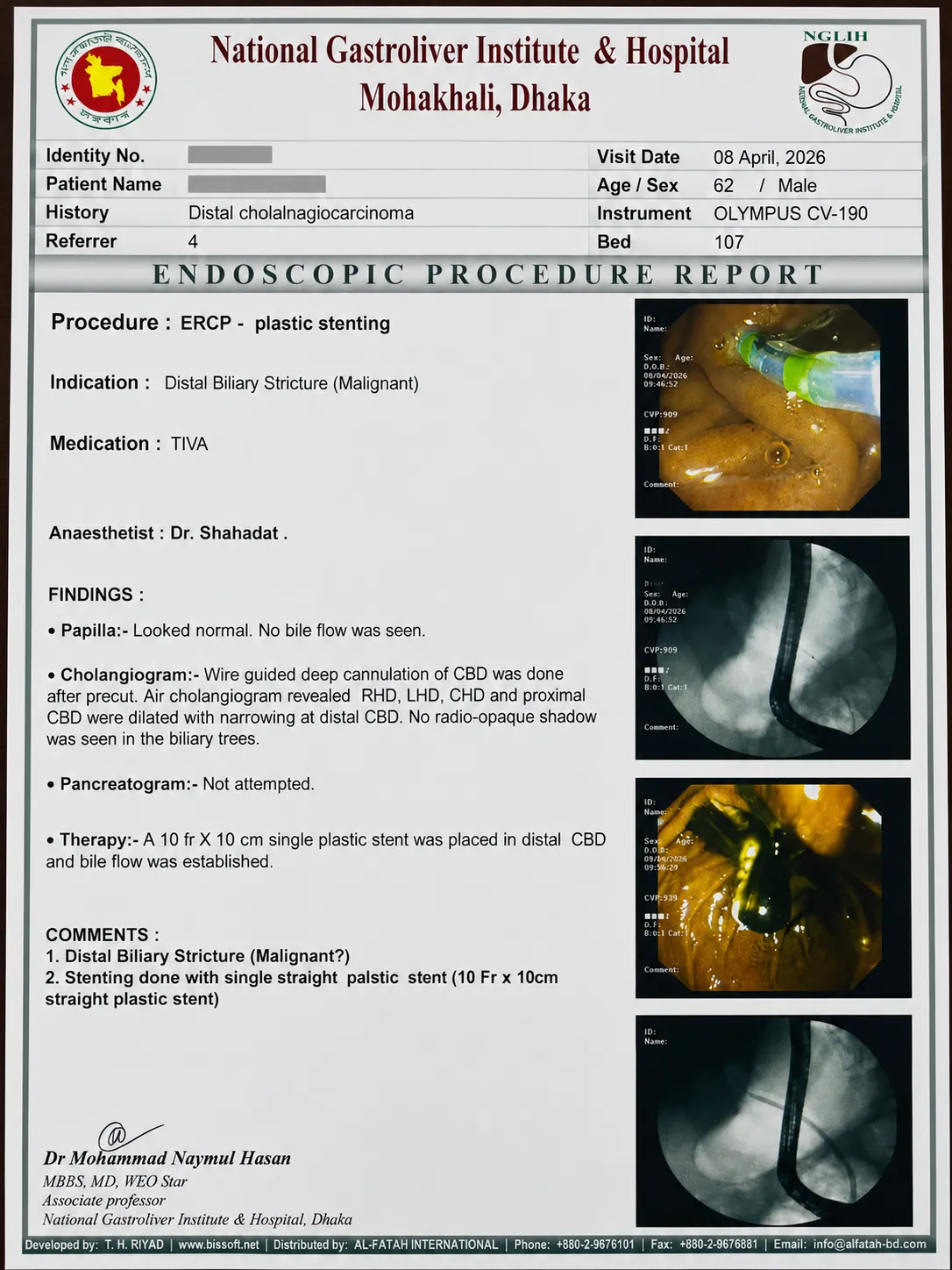 ERCP চলাকালীন endoscopic view